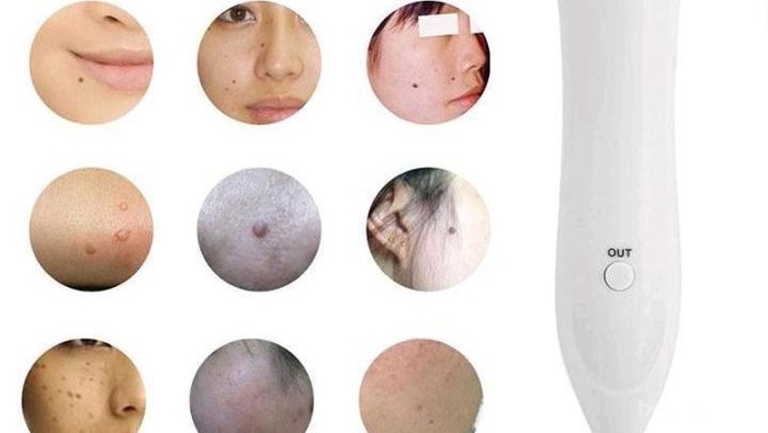 [FORUM] Pen Laser, Ada yang Udah Pernah Pakai?