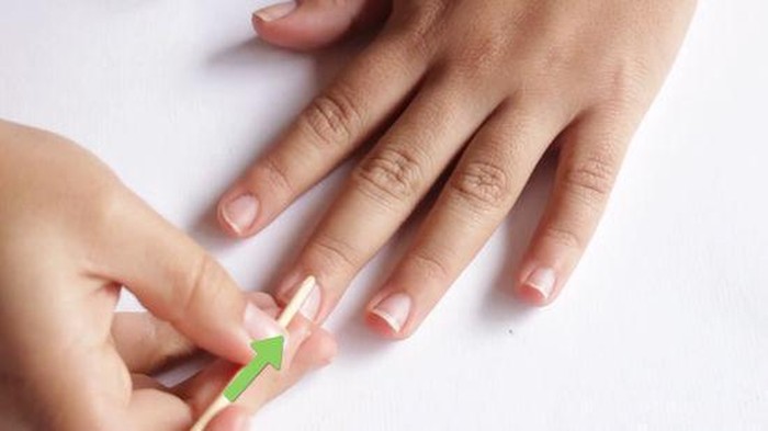 [FORUM] Kenapa kuku aku pendek dan gendut gendut ya?