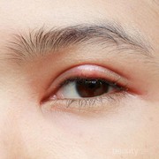 [FORUM] Bintitanku ga ilang2 sudah dua bulan, apa penyebabnya?