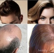 [FORUM] Ladies mau saran biar rambut tebal, help dong