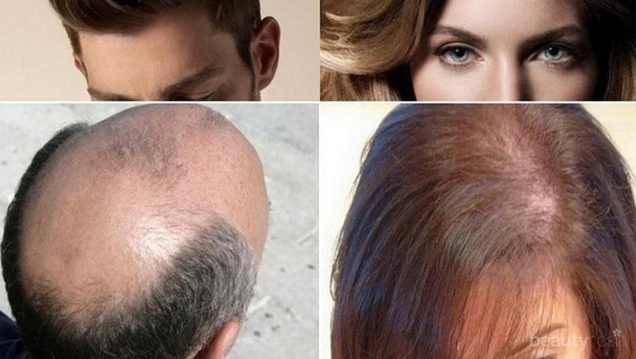 [FORUM] Ladies mau saran biar rambut tebal, help dong