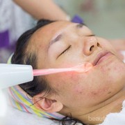 [FORUM] Abis Facial Wajah Jadi Merah, Wajar ya?