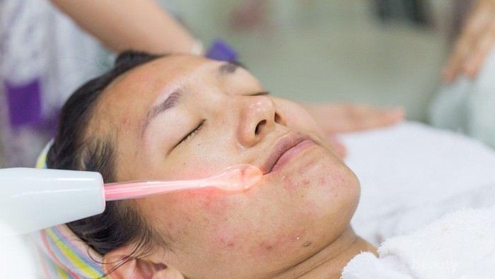 [FORUM] Keseringan facial di klinik, bisa bikin kulit wajah tipis?