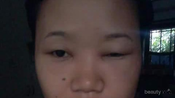 [FORUM] Hati-hati Ladies, Gara-gara Maskara tak layak pakai Mataku Bengkak