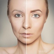 Ladies, Lakukan Cara Unik Ini untuk Menghilangkan Kerutan Pada Wajah