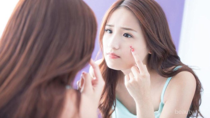 Ingin Kulit yang Mulus? Kamu Perlu Menghindari 5 Makanan Penyebab Jerawat Ini, Ladies!