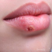 [FORUM] Pernah gatal-gatal atau alergi setelah coba tester makeup di counter?