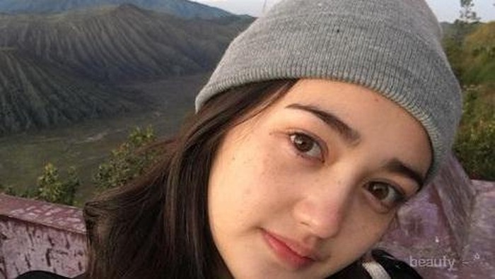 Perawatan Wajah Berjerawat yang Ampuh Bisa Kamu Dapatkan Hanya dengan Sabun JF Sulfur Ini!