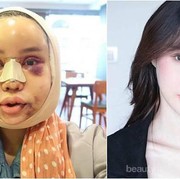 [FORUM] Operasi Plastik apa diperbolehkan dalam Islam?