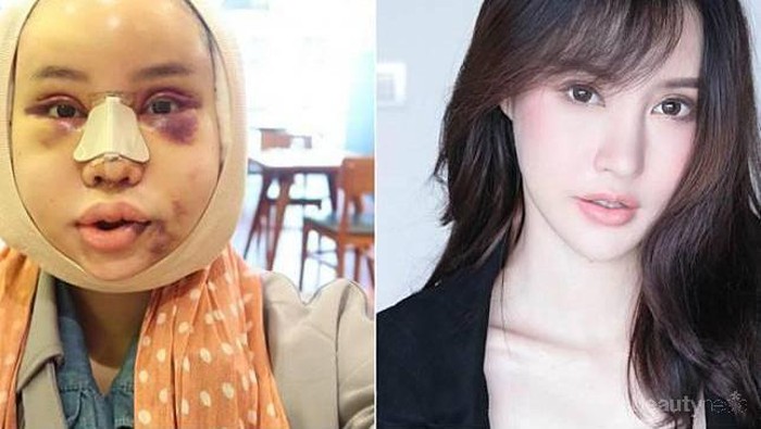 [FORUM] Operasi Plastik apa diperbolehkan dalam Islam?