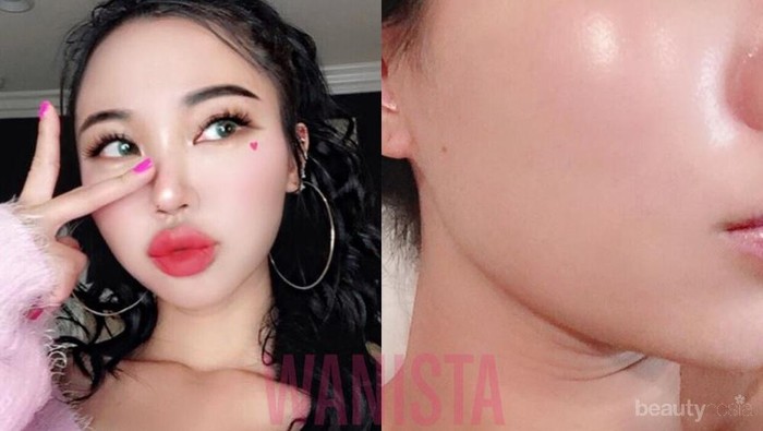 #FORUM Sebenarnya ada gak sih cewek yang ga pernah punya jerawat?