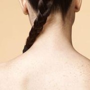 [FORUM] Ampuh! Hilangkan Jerawat di Punggung Selama 3 Minggu
