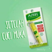 [FORUM] Review Acnes Point Clear, Ternyata Ampuh Kempesin Jerawat!