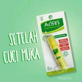 [FORUM] Review Acnes Point Clear, Ternyata Ampuh Kempesin Jerawat!