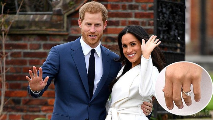 [FORUM] Boleh ga sih lepas cincin pernikahan?