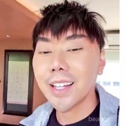 [FORUM] Wajah Baru Roy Kiyoshi, Beneran Oplas?