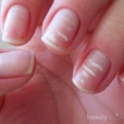 [FORUM] Pernah denger ga mitos kalo putih-putih di kuku pertanda ada yang suka?