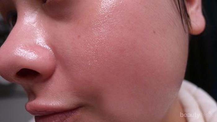 [FORUM] Kulit memerah after facial, wajar gak itu?