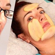 Jerawat Batu Merusak Penampilanmu? Yuk, Hilangkan dengan Cara Mudah Ini Ya Ladies!
