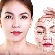 [FORUM] Seberapa perlu pakai pelembap saat udara lembap?