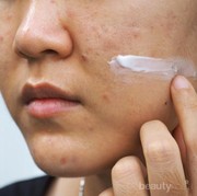 [FORUM] Wajah kamu gampang breakout ga kalau pakai skincare baru?