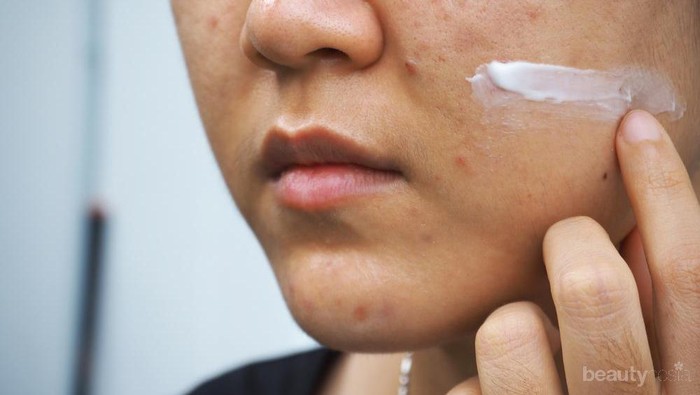 [FORUM] Wajah kamu gampang breakout ga kalau pakai skincare baru?