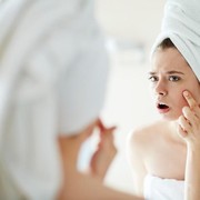 Wow! Bekas Jerawat Hilang Hanya dalam Satu Hari? Ini Caranya!