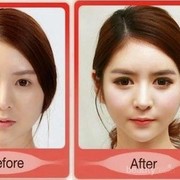 [FORUM] Plastic Surgery sebenernya sah-sah aja ga sih guys?