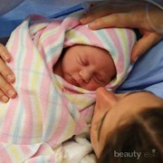 Melahirkan Normal Atau Sesar?