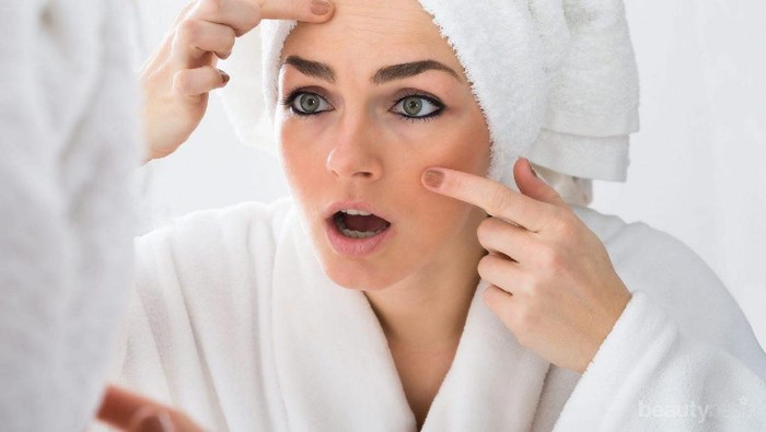 Punya Arti Berbeda, Ternyata Ini Penyebab Jerawat Muncul Berdasarkan Letaknya