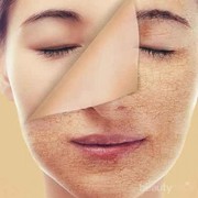 #FORUM Kak, Rekomendasi Skincare untuk Menghindari Kulit Wajah Kering Saat Puasa