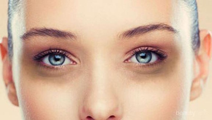 Psst! Ternyata Ini Lho yang Jadi Rahasia Atasi Mata Panda dalam Sehari