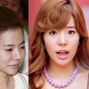 #FORUM Sudah Bruntusan 2 Tahun, Baiknya Pakai Skincare Apa??