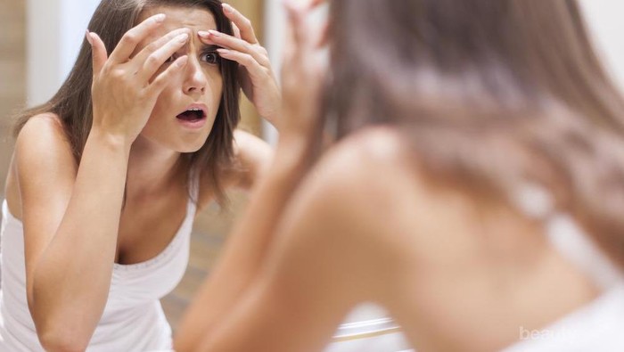 Ingin Mengatasi Jerawat dengan Efektif? Kamu Wajib Menghindari 6 Hal Ini, Ladies!