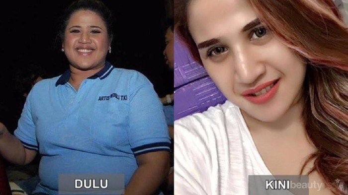 Bikin Pangling, Ini Transformasi Bentuk Tubuh Para Artis Indonesia yang Berhasil Turun Berat Badan!