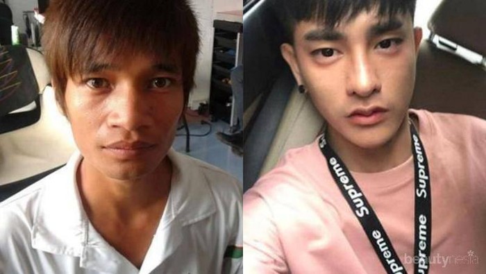 #FORUM Gak Nyangka! Pria Thailand Ini Sudah Operasi Plastik Sebanyak 30 Kali Lho! Gimana Tanggapan Kalian? #FORUM Gak Nyangka! Pria Thailand Ini Sudah Operasi Plastik Sebanyak 30 Kali Lho! Gimana Tanggapan Kalian?