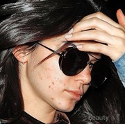 Dear, Bagaimana ya Cara Ampuh Menghilangkan Bruntusan Secara Cepat?