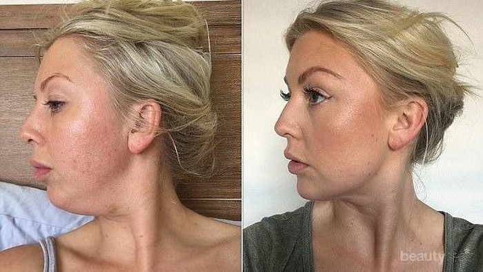 Dari Make Up Hingga Gaya Rambut, Ikuti Trik Ini Agar Double Chin Hilang dan Wajah Lebih Tirus