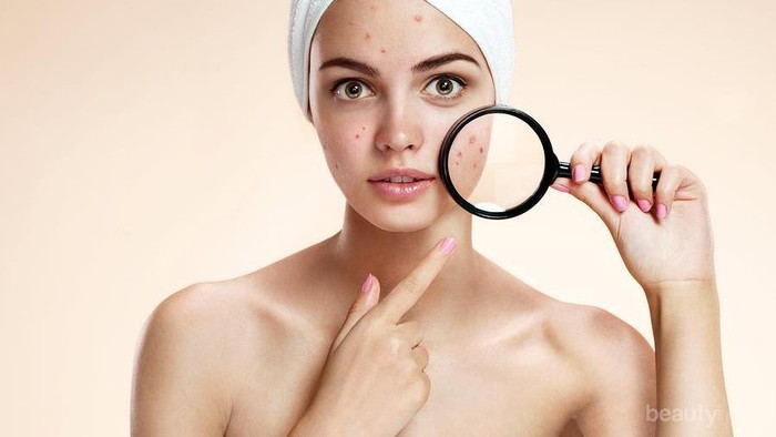 Yuk Usir Jerawat Membandel Dengan 3 Produk Wardah Terbaik Versi Beautynesia Ini! Yuk Usir Jerawat Membandel Dengan 3 Produk Wardah Terbaik Versi Beautynesia Ini!