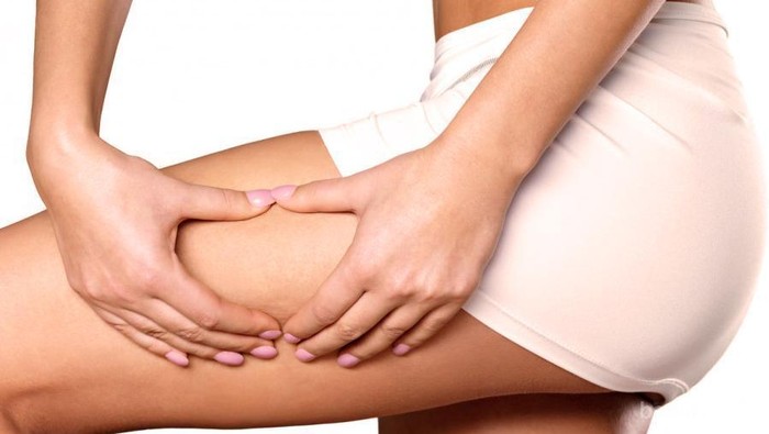 Tak Kunjung Hilang dengan Bahan Alami, Lakukan Cara Ini untuk Hilangkan Selulit!