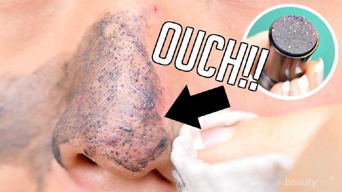 Serupa Tapi Tak Sama, Ini Dia Perbedaan Komedo Hitam dan Komedo Putih