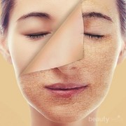 Biar Enggak Salah, Cari Tahu Perbedaan Antara Kulit Normal, Kering, Berminyak, dan Kombinasi Yuk