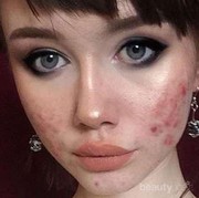 #FORUM Kenapa Sih Kalau Berenti dari Krim Dokter, Kulit Wajah Jadi Makin Memburuk??