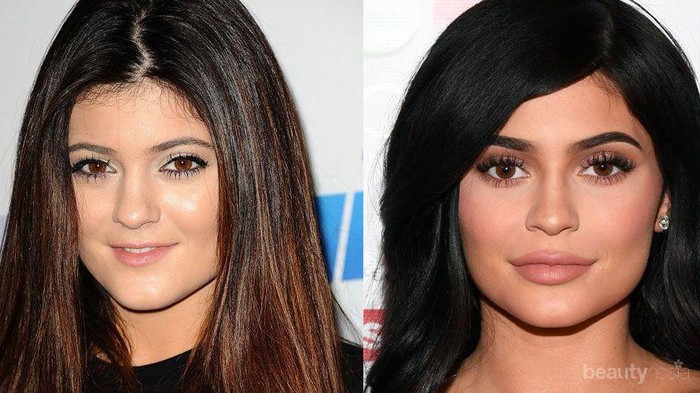 #FORUM Punya Bibir Tipis vs Bibir Tebal, Menurut Kamu Lebih Baik yang Mana? #FORUM Punya Bibir Tipis vs Bibir Tebal, Menurut Kamu Lebih Baik yang Mana?