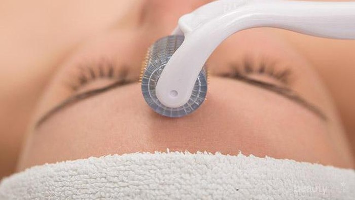 Bingung Cara Atasi Masalah Bekas Jerawat? Coba Inovasi Baru Ini Yuk!