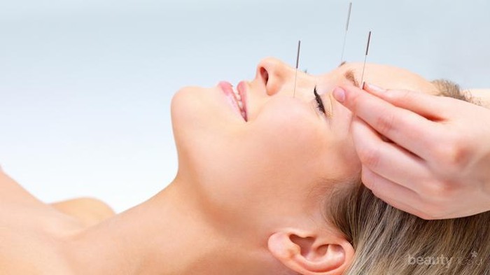 Wow, Rupanya Ini Manfaat Akupuntur Wajah untuk Kecantikan, Berani Coba?