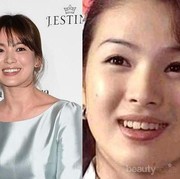 Gak Nyangka! Ternyata Selebriti Korea Ini Dulunya Punya Gigi yang Gak Rapi Lho!