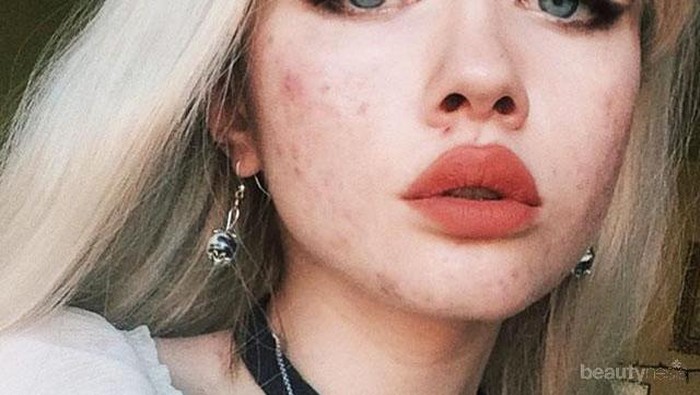 #FORUM Kalau Lagi Jerawatan, Boleh Pakai Foundation atau Bedak Enggak??