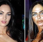 Gagal Operasi Plastik, 5 Artis Berikut Ini Malah Kehilangan Wajah Cantiknya Seperti Ini!