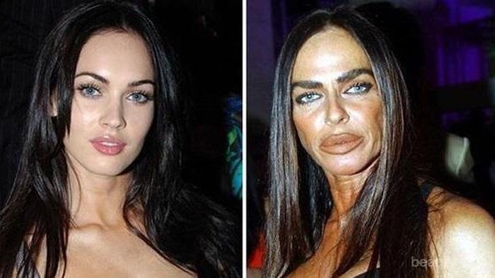 Gagal Operasi Plastik, 5 Artis Berikut Ini Malah Kehilangan Wajah Cantiknya Seperti Ini! Gagal Operasi Plastik, 5 Artis Berikut Ini Malah Kehilangan Wajah Cantiknya Seperti Ini!